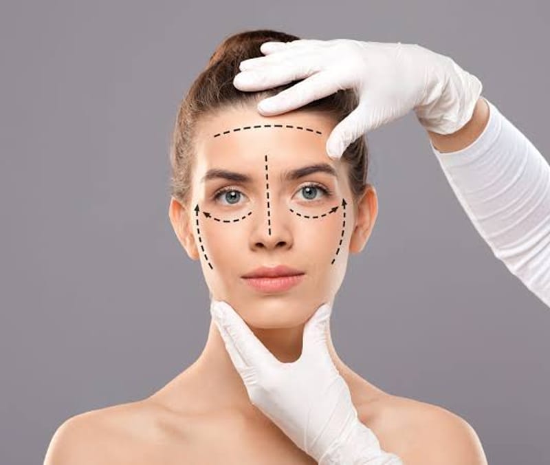 Rosto marcado com linhas de planejamento para harmonização facial